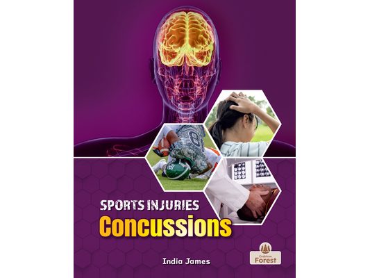 Concussions