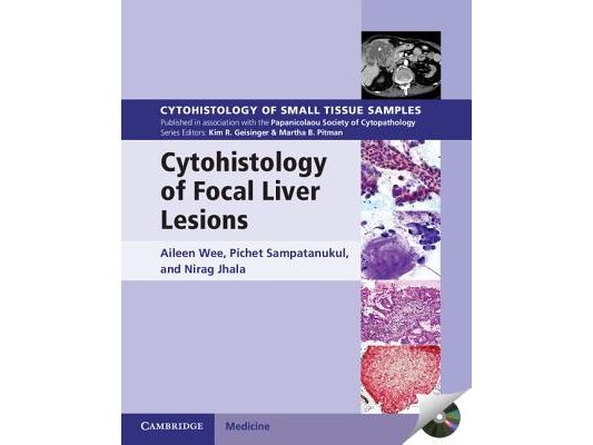 Cytohistology of Focal Liver Lesions