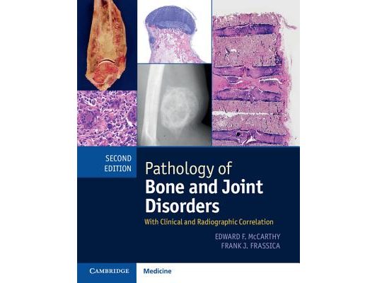 Pathology of Bone and Joint Disorders Print and Online Bundle: With Clinical and Radiographic Correlation