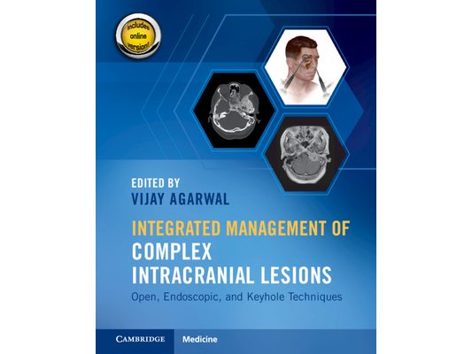 Integrated Management of Complex Intracranial Lesions Hardback Set and Static Online Product: Open, Endoscopic, and Keyhole Techniques