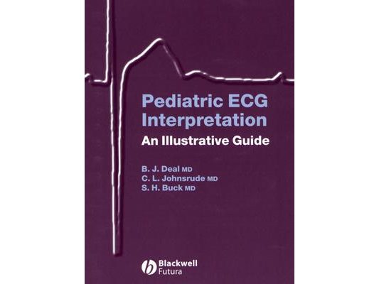Pediatric ECG Interpretation: An Illustrative Guide [With CD]