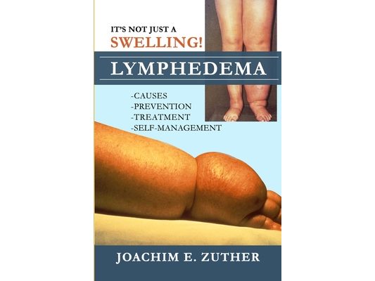 It's Not Just a Swelling! Lymphedema: Causes, Prevention, Treatment, Self-Management