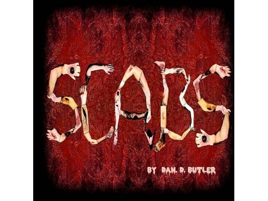 Scabs: Picking Apart The Facts