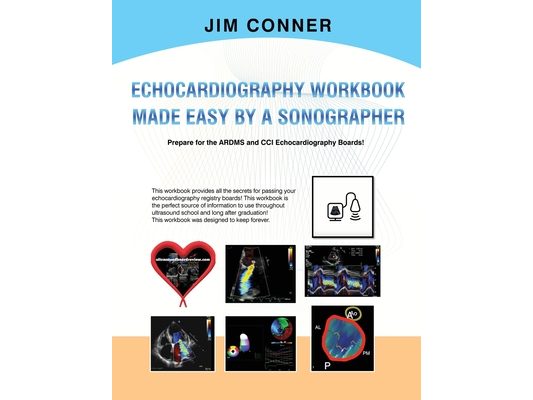 Echocardiography Workbook: Echocardiography Made Easy By A Sonographer
