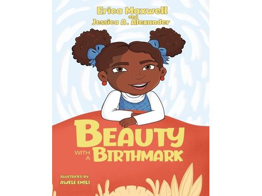Beauty With A Birthmark