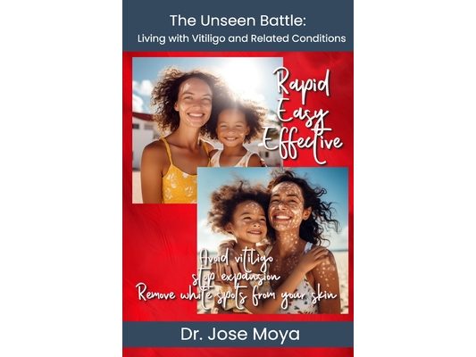 The Unseen Battle: Living with Vitiligo and Related Conditions