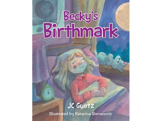 Becky's Birthmark