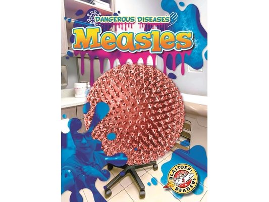Measles