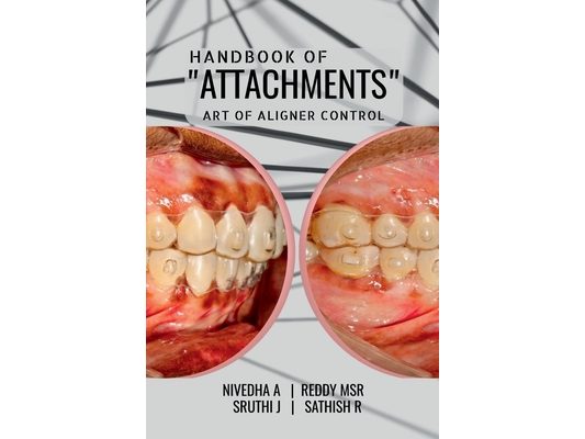 Handbook of "Attachments": Art of Aligner Control