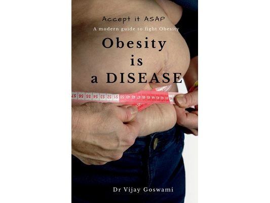 Obesity is a Disease Accept it ASAP: A modern guide to fight obesity