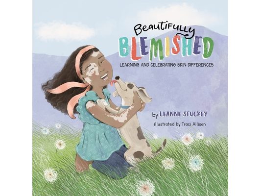 Beautifully Blemished: Learning and Celebrating Skin Differences